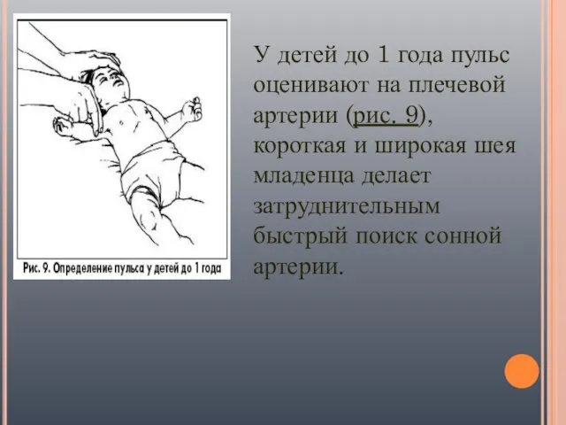 У детей до 1 года пульс оценивают на плечевой артерии (рис.