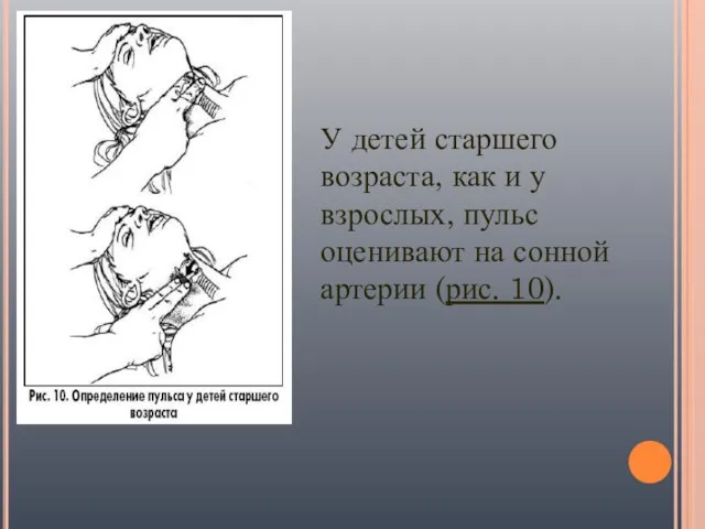 У детей старшего возраста, как и у взрослых, пульс оценивают на сонной артерии (рис. 10).