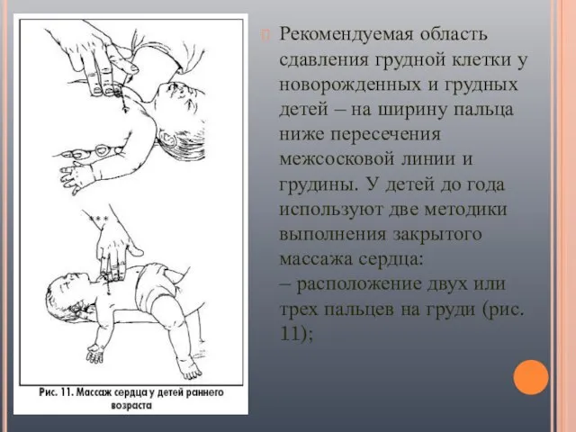 Рекомендуемая область сдавления грудной клетки у новорожденных и грудных детей –