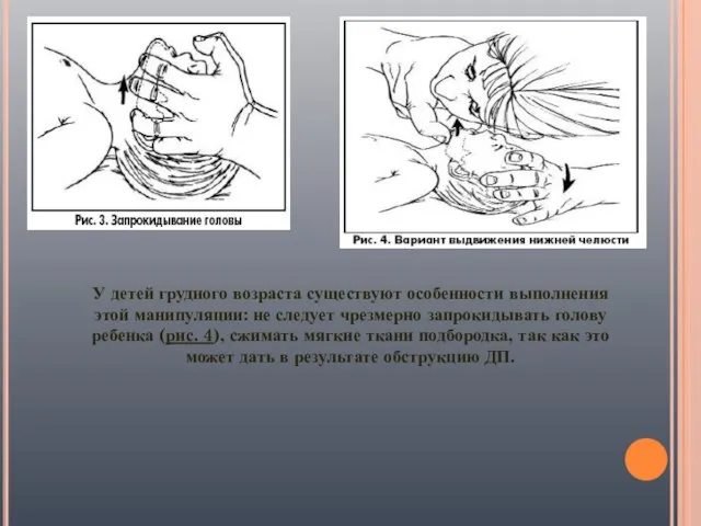 У детей грудного возраста существуют особенности выполнения этой манипуляции: не следует