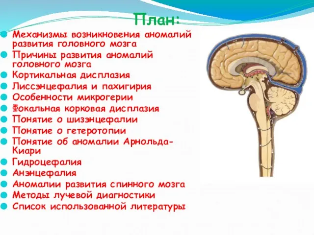 План: Механизмы возникновения аномалий развития головного мозга Причины развития аномалий головного