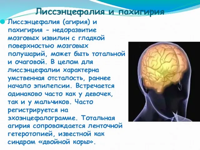 Лиссэнцефалия и пахигирия Лиссэнцефалия (агирия) и пахигирия - недоразвитие мозговых извилин