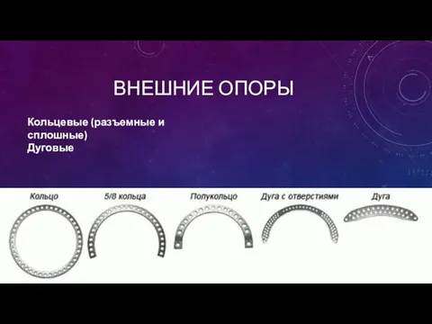 ВНЕШНИЕ ОПОРЫ Кольцевые (разъемные и сплошные) Дуговые