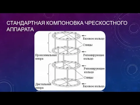 СТАНДАРТНАЯ КОМПОНОВКА ЧРЕСКОСТНОГО АППАРАТА