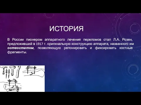 ИСТОРИЯ В России пионером аппаратного лечения переломов стал Л.А. Розен, предложивший