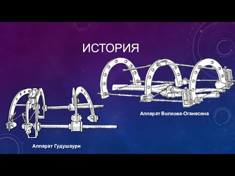 ИСТОРИЯ Аппарат Гудушаури Аппарат Волкова-Оганесяна