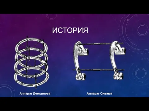 ИСТОРИЯ Аппарат Демьянова Аппарат Сиваша