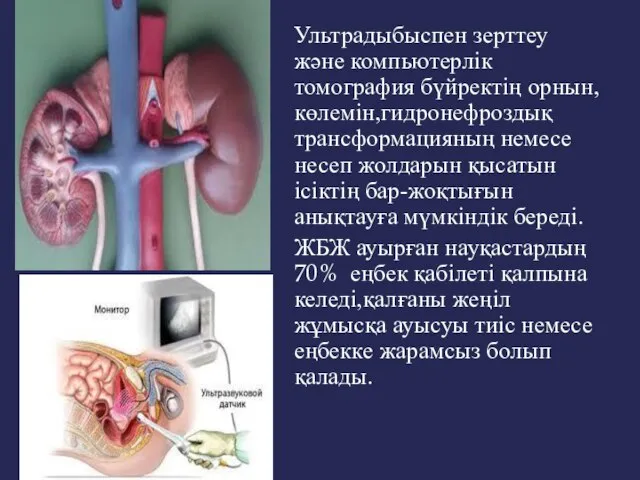 Ультрадыбыспен зерттеу және компьютерлік томография бүйректің орнын,көлемін,гидронефроздық трансформацияның немесе несеп жолдарын