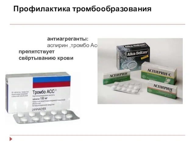 Профилактика тромбообразования антиагреганты: аспирин ,тромбо Асс препятствует свёртыванию крови