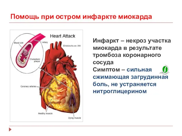 Помощь при остром инфаркте миокарда Инфаркт – некроз участка миокарда в