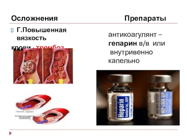 Осложнения Препараты Г.Повышенная вязкость крови - тромбоз антикоагулянт – гепарин в/в или внутривенно капельно
