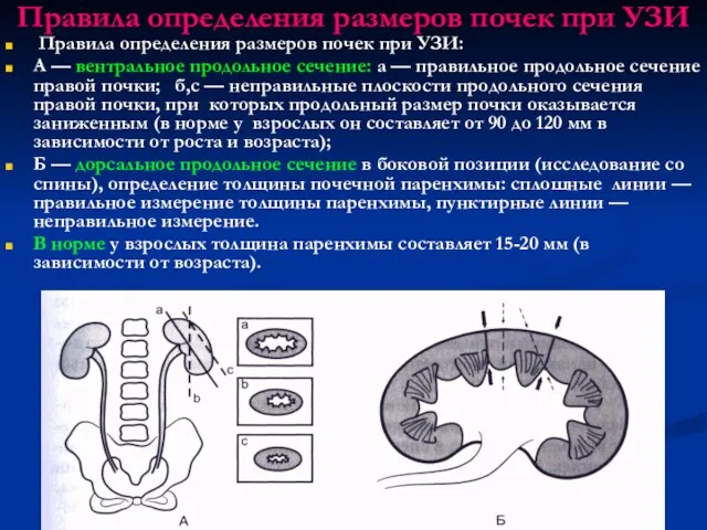 Правила определения размеров почек при УЗИ Правила определения размеров почек при