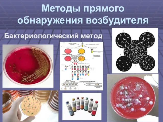 Методы прямого обнаружения возбудителя Бактериологический метод
