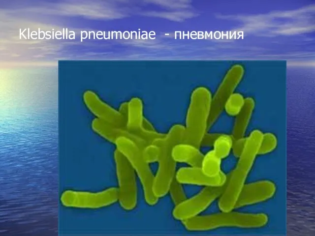 Klebsiella pneumoniae - пневмония