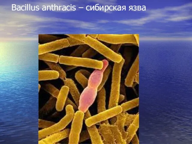 Bacillus anthracis – сибирская язва