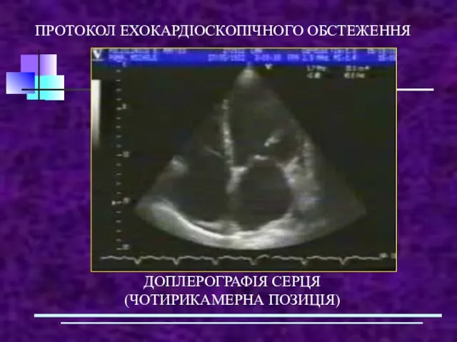 ПРОТОКОЛ ЕХОКАРДІОСКОПІЧНОГО ОБСТЕЖЕННЯ ДОПЛЕРОГРАФІЯ СЕРЦЯ (ЧОТИРИКАМЕРНА ПОЗИЦІЯ)