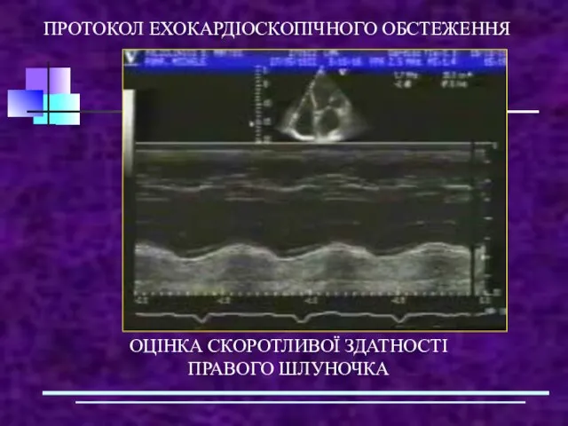 ПРОТОКОЛ ЕХОКАРДІОСКОПІЧНОГО ОБСТЕЖЕННЯ ОЦІНКА СКОРОТЛИВОЇ ЗДАТНОСТІ ПРАВОГО ШЛУНОЧКА