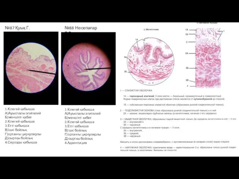 №87 Қуық Г.Э 1.Кілегей қабықша А)Ауыспалы эпителий Б)меншікті қабат 2.Кілегей қабықша