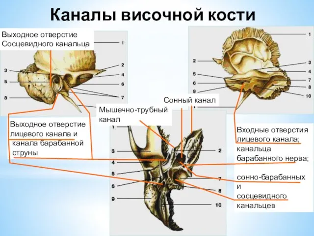 Каналы височной кости Выходное отверстие лицевого канала и канала барабанной струны