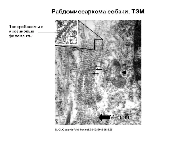 Рабдомиосаркома собаки. ТЭМ B. G. Caserto Vet Pathol 2013;50:806-826 Полирибосомы и миозиновые филаменты М-линия