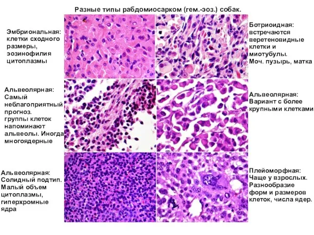 Разные типы рабдомиосарком (гем.-эоз.) собак. Эмбриональная: клетки сходного размеры, эозинофилия цитоплазмы