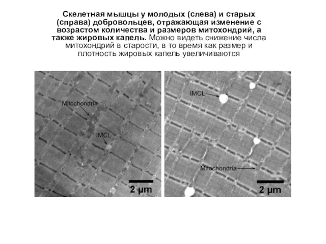 Скелетная мышцы у молодых (слева) и старых (справа) добровольцев, отражающая изменение