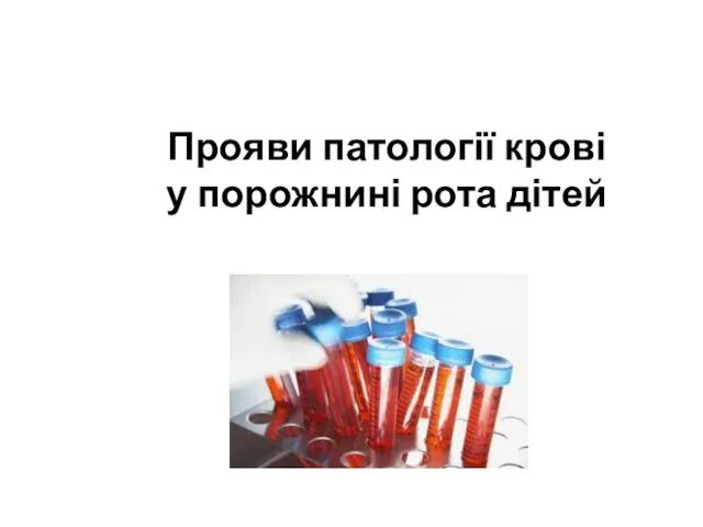 Прояви патології крові у порожнині рота дітей