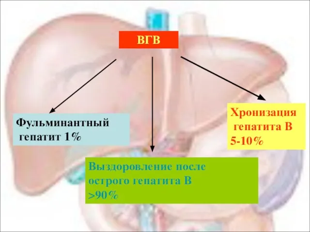 ВГВ Выздоровление после острого гепатита В >90% Фульминантный гепатит 1% Хронизация гепатита В 5-10%