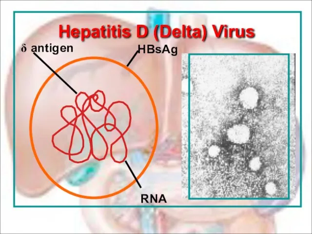 Hepatitis D (Delta) Virus HBsAg RNA δ antigen