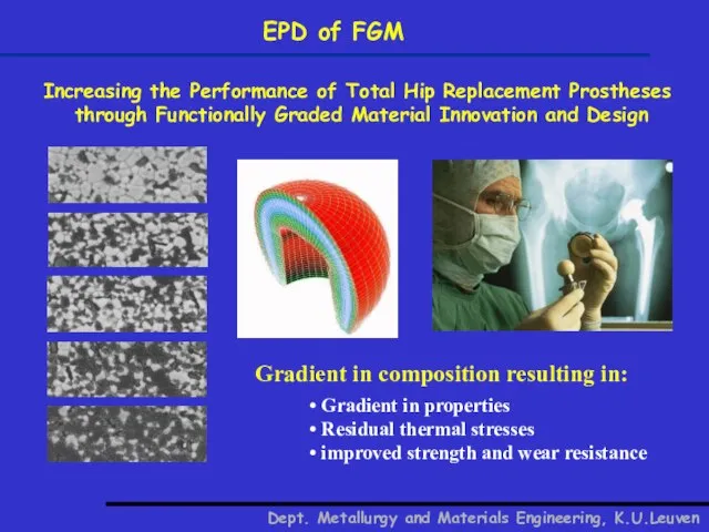 EPD of FGM Increasing the Performance of Total Hip Replacement Prostheses
