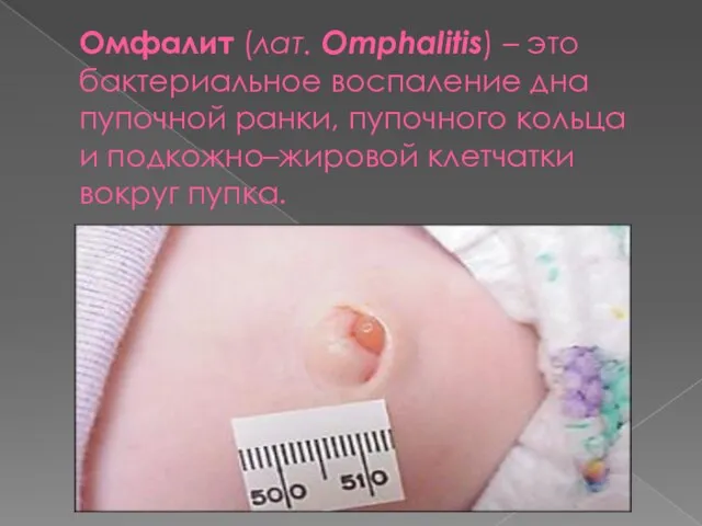 Омфалит (лат. Omphalitis) – это бактериальное воспаление дна пупочной ранки, пупочного