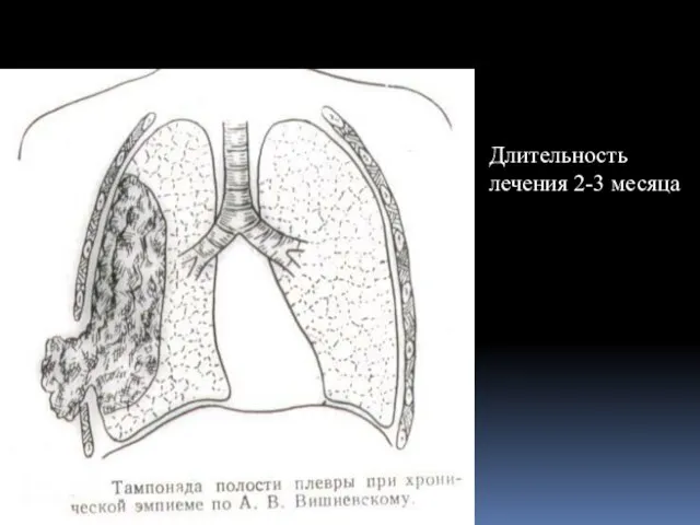 Длительность лечения 2-3 месяца