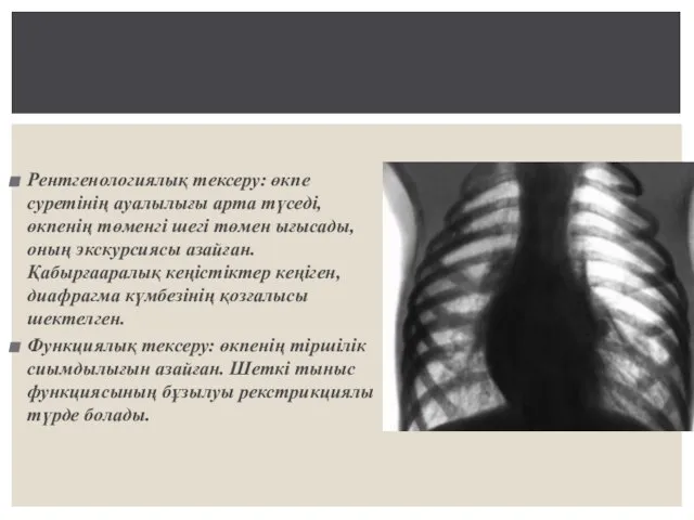Рентгенологиялық тексеру: өкпе суретінің ауалылығы арта түседі, өкпенің төменгі шегі төмен