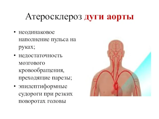 Атеросклероз дуги аорты неодинаковое наполнение пульса на руках; недостаточность мозгового кровообращения,