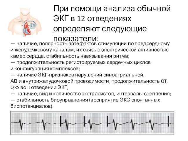 — наличие, полярность артефактов стимуляции по предсердному и желудочковому каналам, их