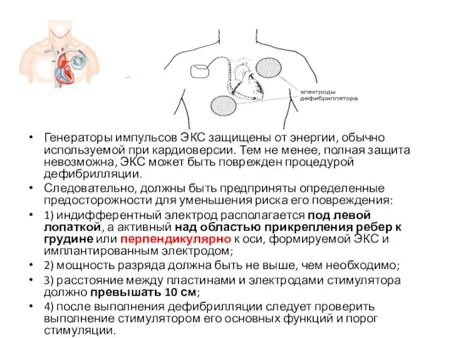 Генераторы импульсов ЭКС защищены от энергии, обычно используемой при кардиоверсии. Тем