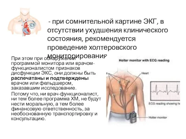 При этом при обнаружении программой монитора или врачом-функционалистом признаков дисфункции ЭКС,