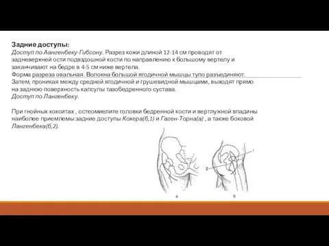 Задние доступы: Доступ по Аангенбеку-Гибсону. Разрез кожи длиной 12-14 см проводят