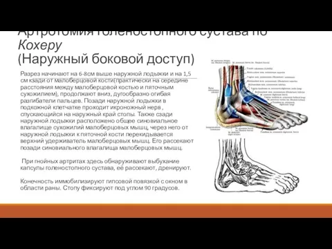 Артротомия голеностопного сустава по Кохеру (Наружный боковой доступ) Разрез начинают на