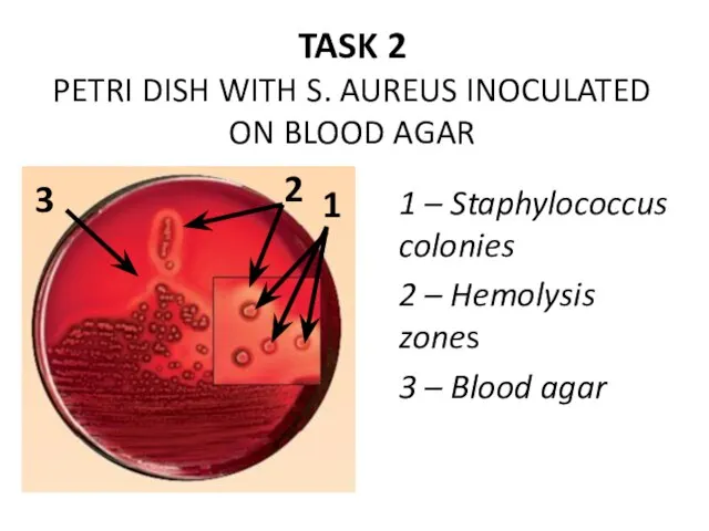 TASK 2 PETRI DISH WITH S. AUREUS INOCULATED ON BLOOD AGAR