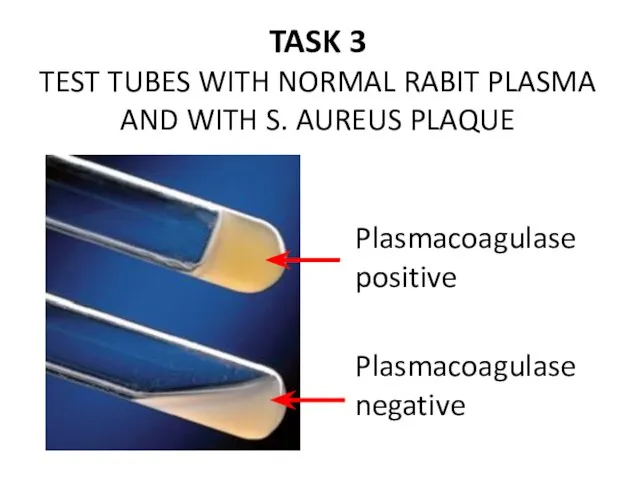 TASK 3 TEST TUBES WITH NORMAL RABIT PLASMA AND WITH S.