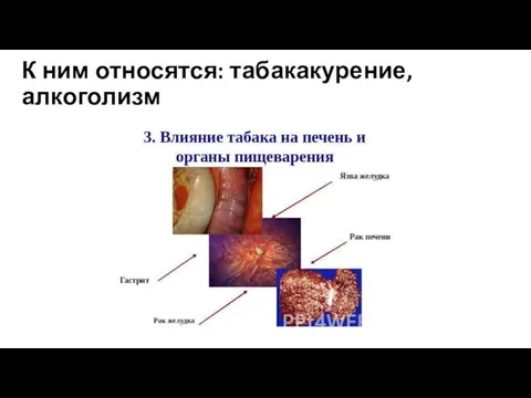 К ним относятся: табакакурение,алкоголизм