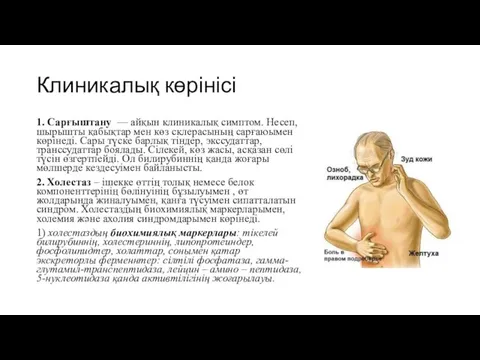 Клиникалық көрінісі 1. Сарғыштану — айқын клиникалық симптом. Несеп, шырышты қабықтар