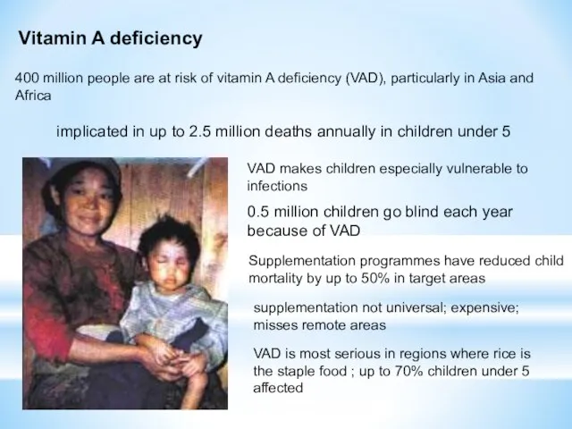 400 million people are at risk of vitamin A deficiency (VAD),