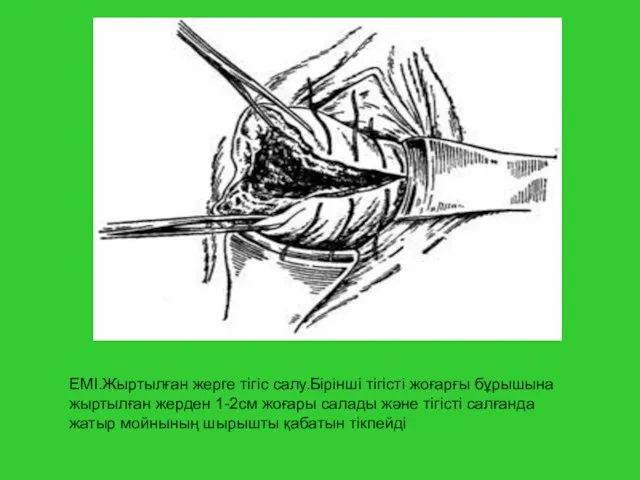 ЕМІ.Жыртылған жерге тігіс салу.Бірінші тігісті жоғарғы бұрышына жыртылған жерден 1-2см жоғары