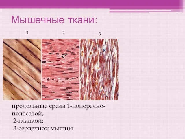 Мышечные ткани: продольные срезы 1-поперечно-полосатой, 2-гладкой; 3-сердечной мышцы 1 2 3