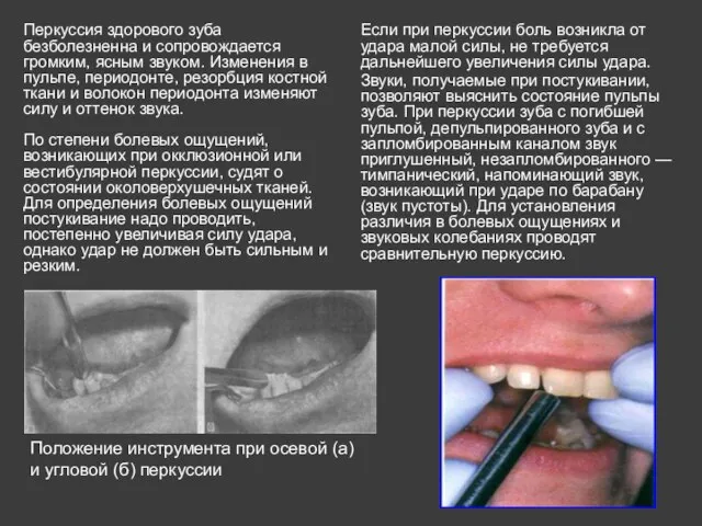 Перкуссия здорового зуба безболезненна и сопровождается громким, ясным звуком. Изменения в