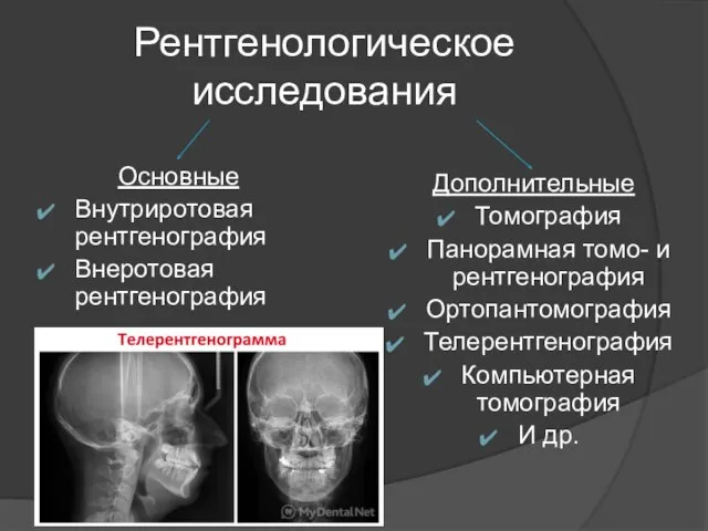 Рентгенологическое исследования Основные Внутриротовая рентгенография Внеротовая рентгенография Дополнительные Томография Панорамная томо-