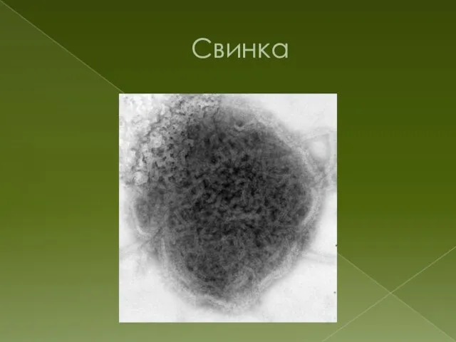 Свинка