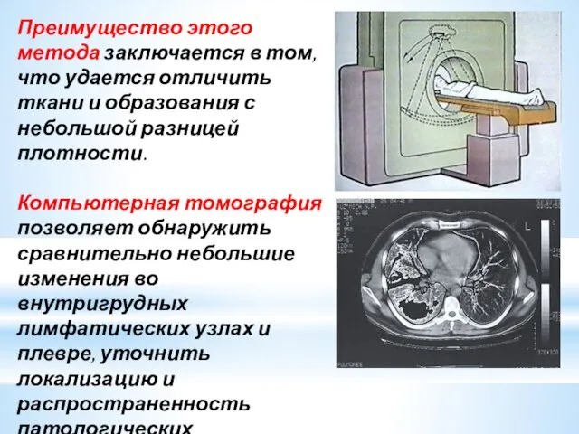 Преимущество этого метода заключается в том, что удается отличить ткани и